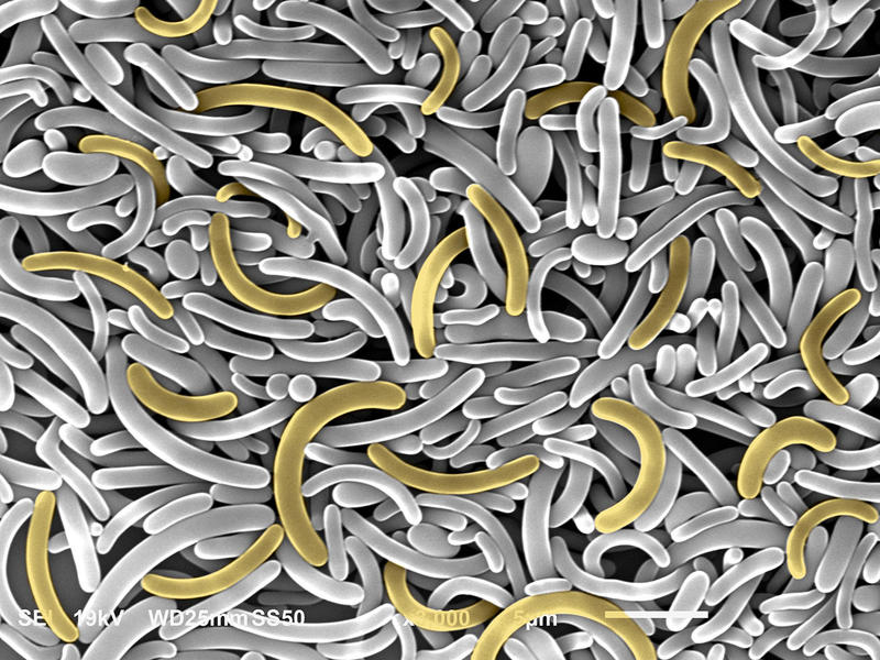 scanning electron microscopy image of colloidal bananas